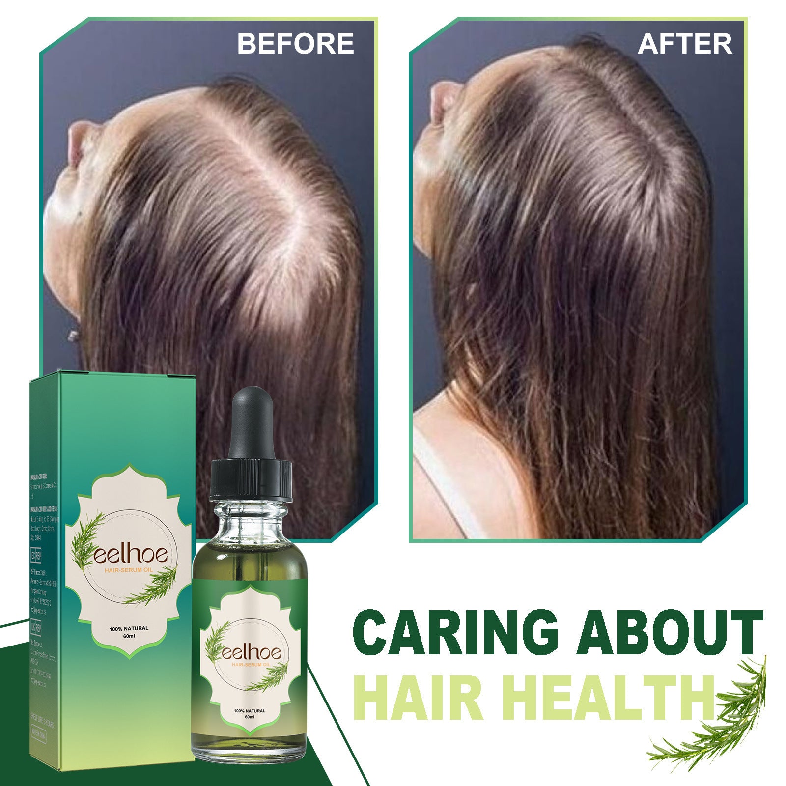 Nourishing Anti-hair Loss Thick Hair Care pr